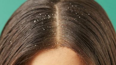 التخلص من قشرة الشعر في 5 نصائح فقط