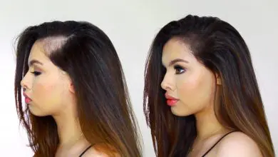 7 حلول طبيعية للتخلص من الصلع عند النساء