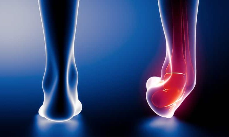 علاج ألم مفصل القدم