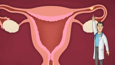 تجربتي مع الحمل خارج الرحم