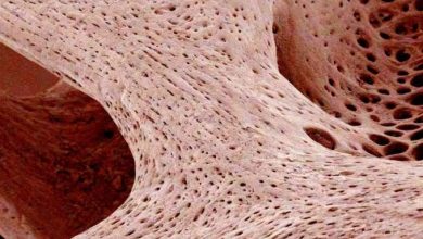 ماذا تسمى الخلايا التي تتخلص من الأنسجة العظمية الهرمة