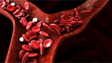 يحمل الدم النواتج المطروحة من نشاط الخلية إلى …………..؛ ليتخلص منها