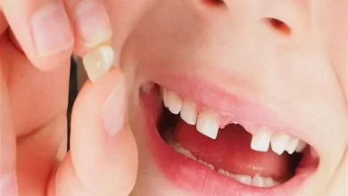 تفسير حلم سقوط الاسنان في المنام