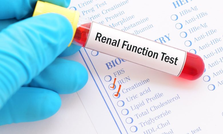 شروط تحليل وظائف الكلى وهل يحتاج صيام