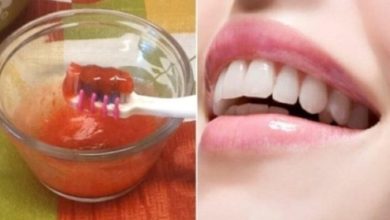 الخلطة الطبيعية الرائعة والمثالية في تبييض الأسنان بسهولة