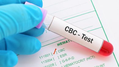 هل فحص cbc يكشف الإيدز بعد الإصابة