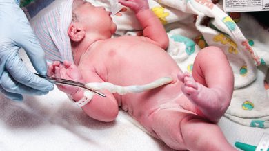 أهمية تخزين خلايا الحبل السري لحديثي الولادة