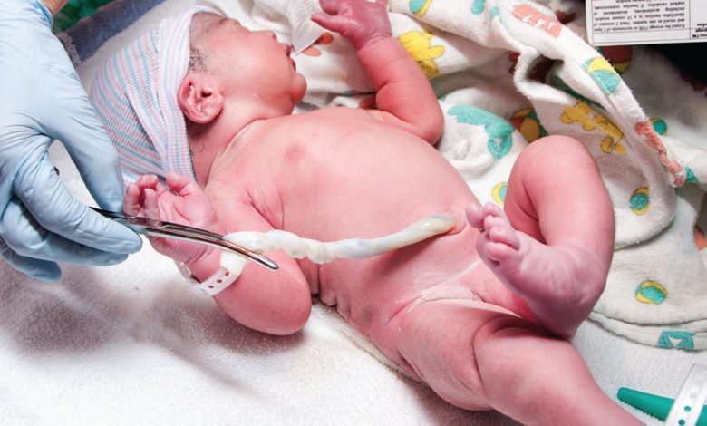 أهمية تخزين خلايا الحبل السري لحديثي الولادة