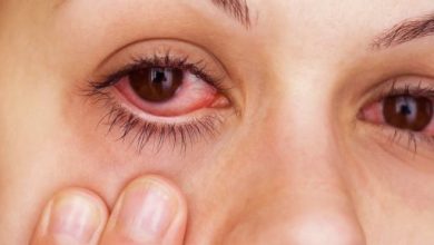 علاجات طبيعية لتخفيف انتفاخ العين بعد البكاء