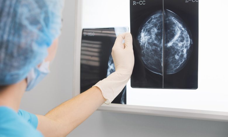 سرطان الثدي خطوات الفحص الذاتي والإشعاعى
