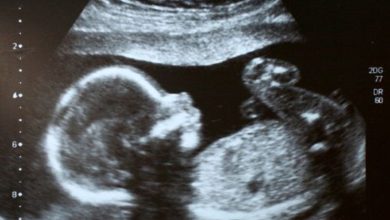 بنت أم ولد.. هل تختلف حركة الجنين حسب نوعه؟