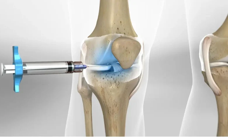 حقن الركبة لعلاج الخشونة.. الأسباب، المميزات والأنواع