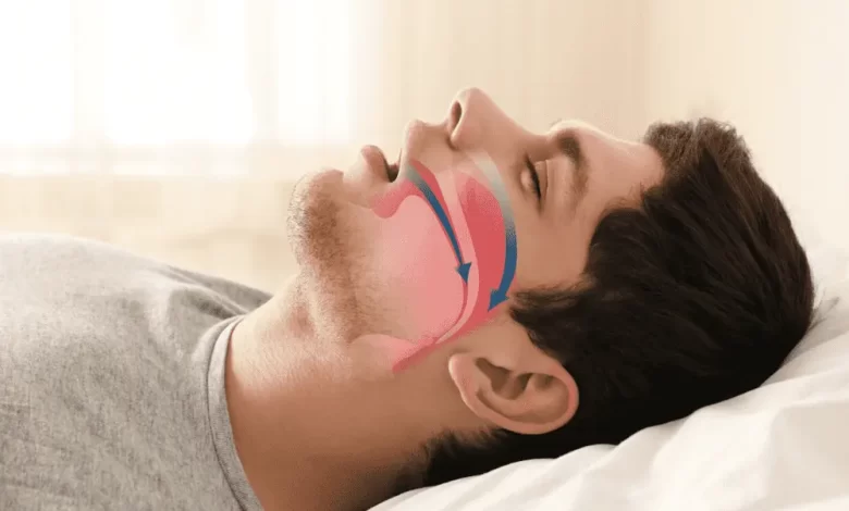 انقطاع التنفس الانسدادي أثناء النوم مشكلةٌ خطيرة