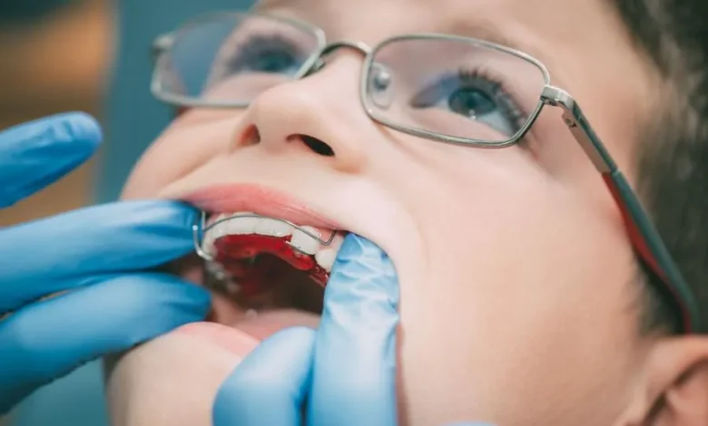 أفضل أعمار لبدء تقويم أسنان الأطفال دليل شامل