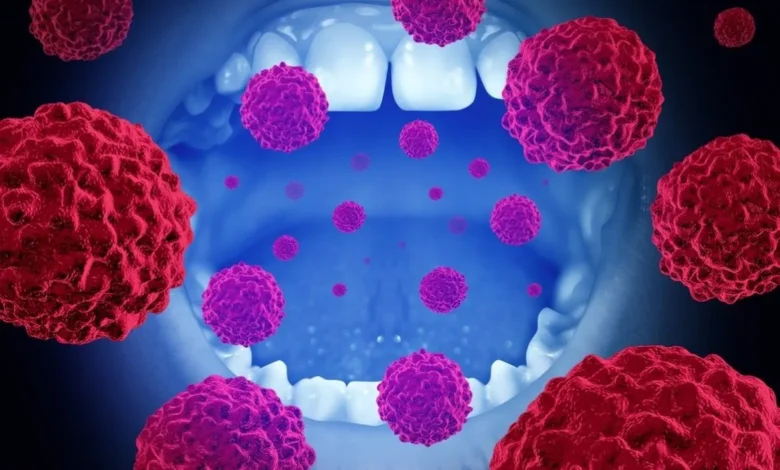 الكشف المبكر عن سرطان الفم أعراض يجب عدم تجاهلها