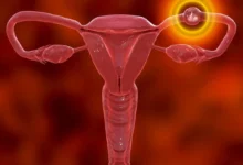 الحمل في قناة فالوب تأثيره على الإنجاب والعلاج الممكن