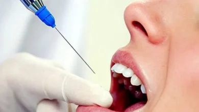 نصائح مهمة لتناول الطعام بعد إجراء بنج للأسنان