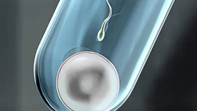 عيوب الحقن المجهري أهم المخاطر والسلبيات قبل بدء العلاج