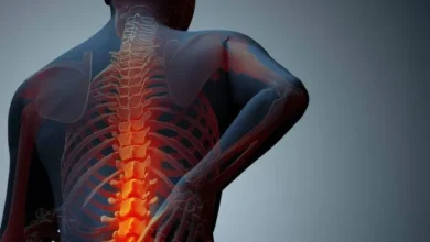 علاج احتكاك فقرات الظهر بالأعشاب والطب البديل
