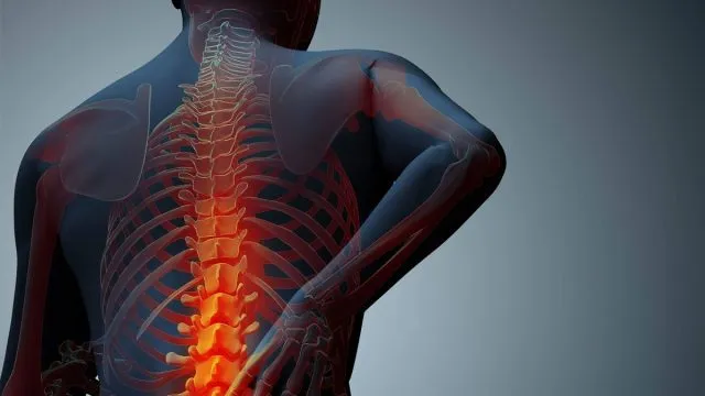 علاج احتكاك فقرات الظهر بالأعشاب والطب البديل