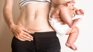 أهم 6 علامات الشفاء من العملية القيصرية