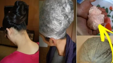 تجربتي مع سنام الجمل للشعر والبشرة