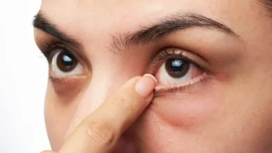 ما هي أسباب دخول العين للداخل وعلاجها؟