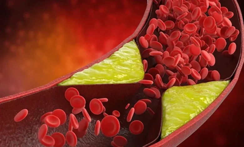 6 عادات ترفع الدهون الثلاثية وتضر بصحة القلب