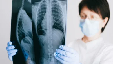 أعراض جلطة الرئة العلامات الخطيرة ومتى تذهب إلى الطوارئ؟