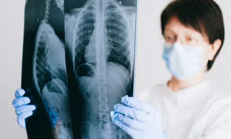 أعراض جلطة الرئة العلامات الخطيرة ومتى تذهب إلى الطوارئ؟