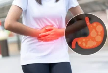 انتفاخ البطن في سن اليأس وأسبابه وطرق التخفيف منه