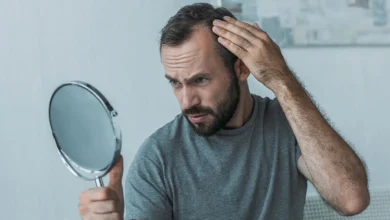 تساقط الشعر مع أدوية إنقاص الوزن