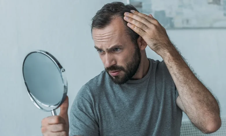 تساقط الشعر مع أدوية إنقاص الوزن