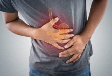 حموضة المعدة في الصيف الأسباب والأعراض وطرق العلاج والوقاية