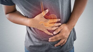حموضة المعدة في الصيف الأسباب والأعراض وطرق العلاج والوقاية