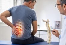 الانزلاق الفقاري الأسباب والأعراض والعلاج ومتى تحتاج الجراحة؟